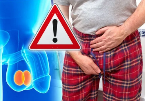 Áp xe bìu tinh hoàn: Nguyên nhân, dấu hiệu và cách điều trị