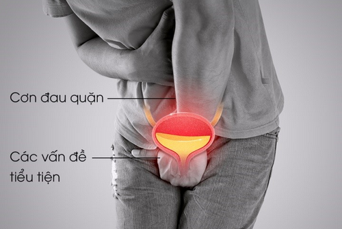 Tiểu buốt đau sót: Nguyên nhân, dấu hiệu và cách điều trị hiệu quả