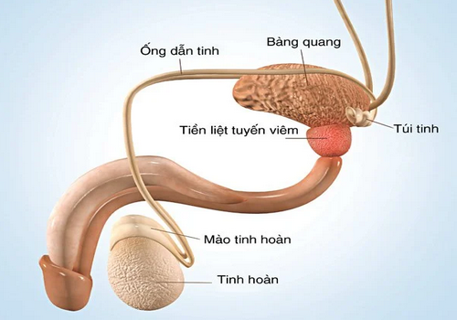 Phương pháp điều trị viêm tuyến tiền liệt chuẩn y khoa