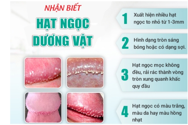 Nguyên nhân và dấu hiệu nhận biết bệnh hạt ngọc dương vật 12